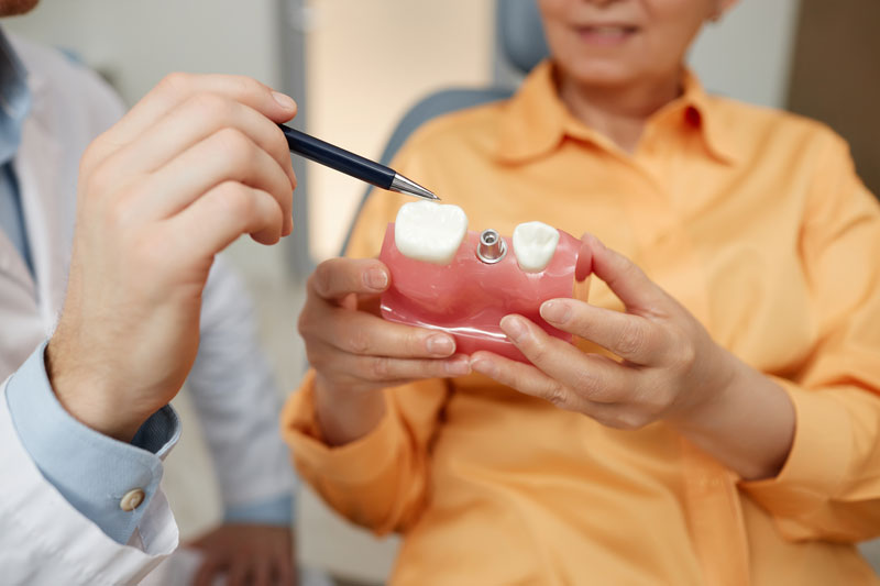 Uncover the Lifespan: How Long Can a Dental Implant Last?